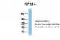 RPS14 antibody - middle region